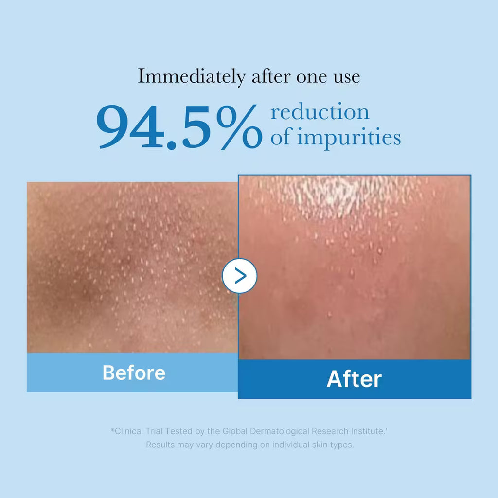 medicube Zero Pore Blackhead Deep Cleansing Oil