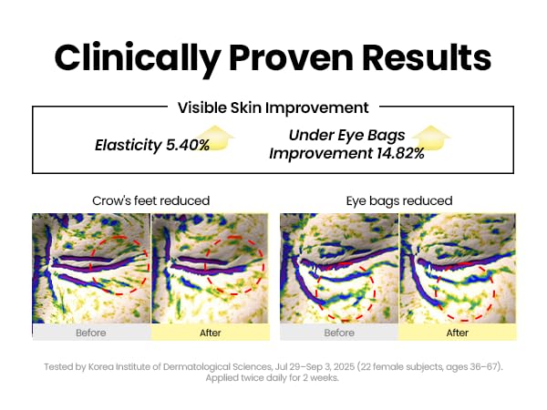 K-SECRET SEOUL 1988 Retinal Eye Cream