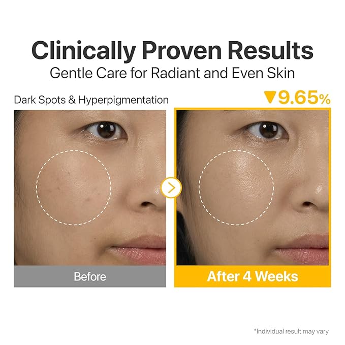 numbuzin No.5 Serum 30ml | Tranexamic Acid 4%, Niacinamide 5%, Glutathione, Vitamin C