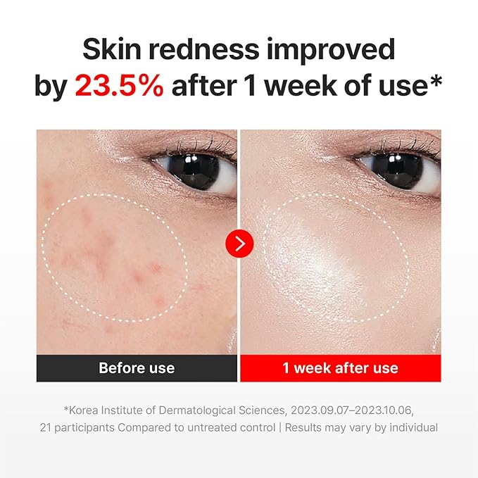 CENTELLIAN 24 Madeca Cream Time Reverse