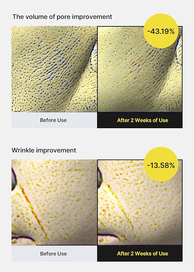 celimax The Vita A Retinal Shot Tightening Booster